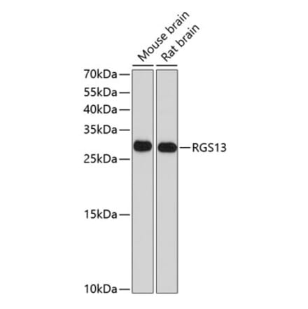 Western Blot - Anti-RGS13 Antibody (A17145) - Antibodies.com