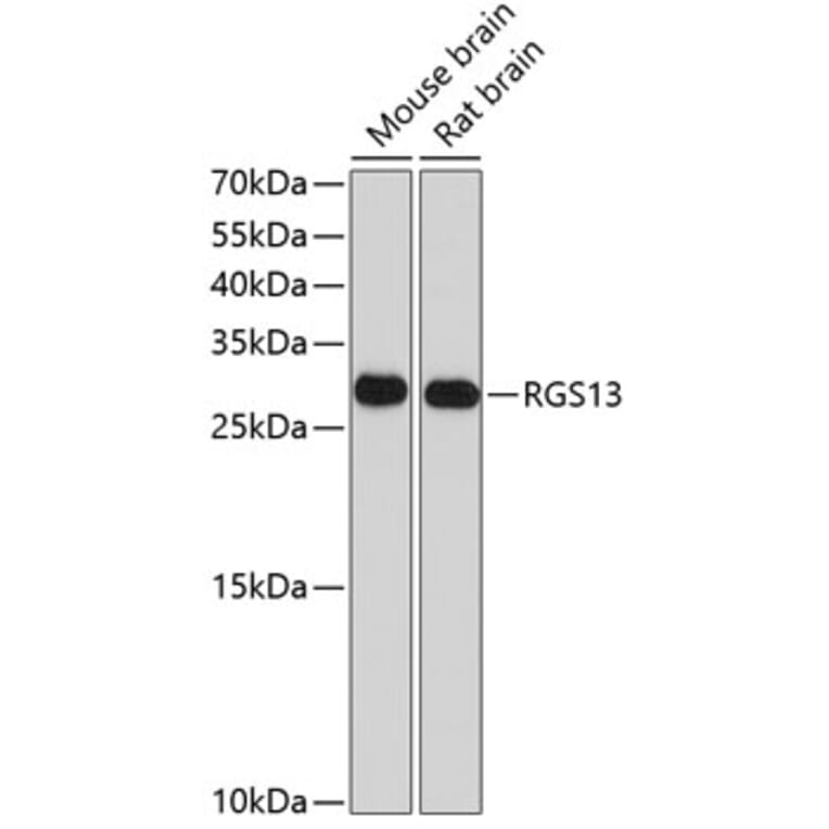 Western Blot - Anti-RGS13 Antibody (A17145) - Antibodies.com