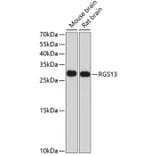 Western Blot - Anti-RGS13 Antibody (A17145) - Antibodies.com