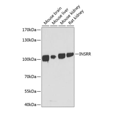 Western Blot - Anti-IRR Antibody (A17146) - Antibodies.com