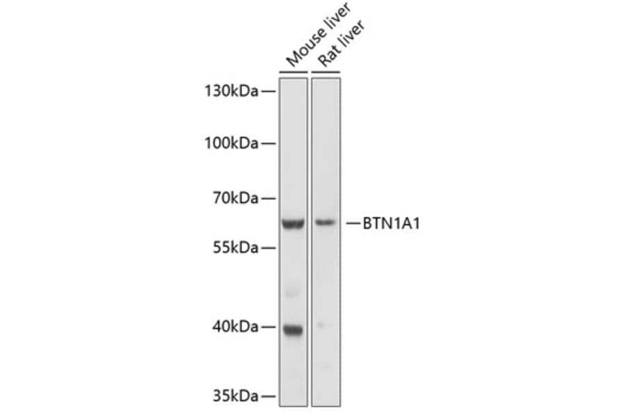 Western Blot - Anti-BTN1A1 Antibody (A10107) - Antibodies.com