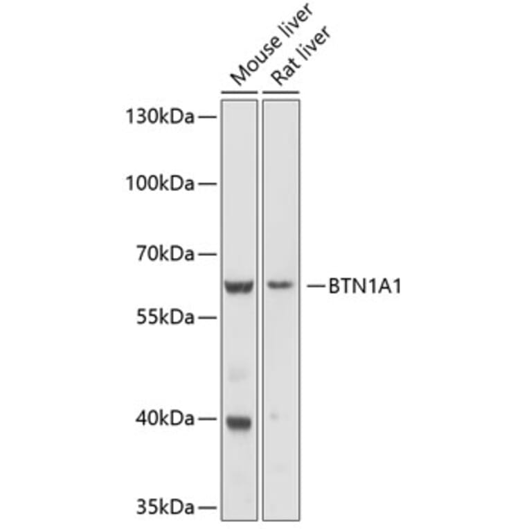 Western Blot - Anti-BTN1A1 Antibody (A10107) - Antibodies.com