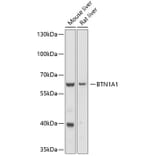 Western Blot - Anti-BTN1A1 Antibody (A10107) - Antibodies.com