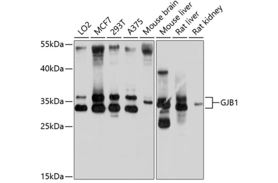 Western Blot - Anti-Connexin 32/GJB1 Antibody (A17148) - Antibodies.com
