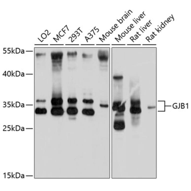 Western Blot - Anti-Connexin 32/GJB1 Antibody (A17148) - Antibodies.com