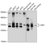 Western Blot - Anti-Connexin 32/GJB1 Antibody (A17148) - Antibodies.com