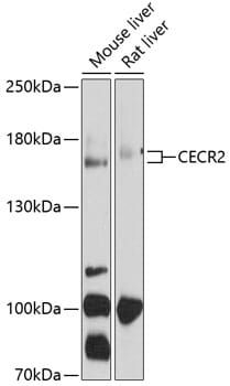 Western blot analysis of extracts of various cell lines, using Anti-CECR2 Antibody (A10143) at 1:1,000 dilution. Secondary antibody: Goat Anti-Rabbit IgG (H+L) (HRP) (AS014) at 1:10,000 dilution. Lysates / proteins: 25µg per lane. Blocking buffer: 3% non-fat dry milk in TBST. Detection: ECL Enhanced Kit (RM00021). Exposure time: 60s.
