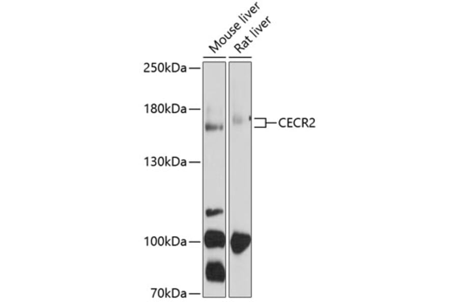 Western Blot - Anti-CECR2 Antibody (A17149) - Antibodies.com