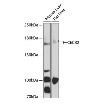 Western Blot - Anti-CECR2 Antibody (A17149) - Antibodies.com