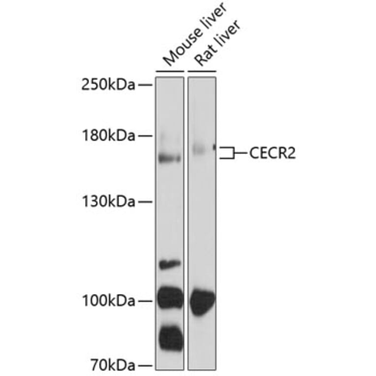 Western Blot - Anti-CECR2 Antibody (A17149) - Antibodies.com