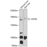 Western Blot - Anti-CECR2 Antibody (A17149) - Antibodies.com