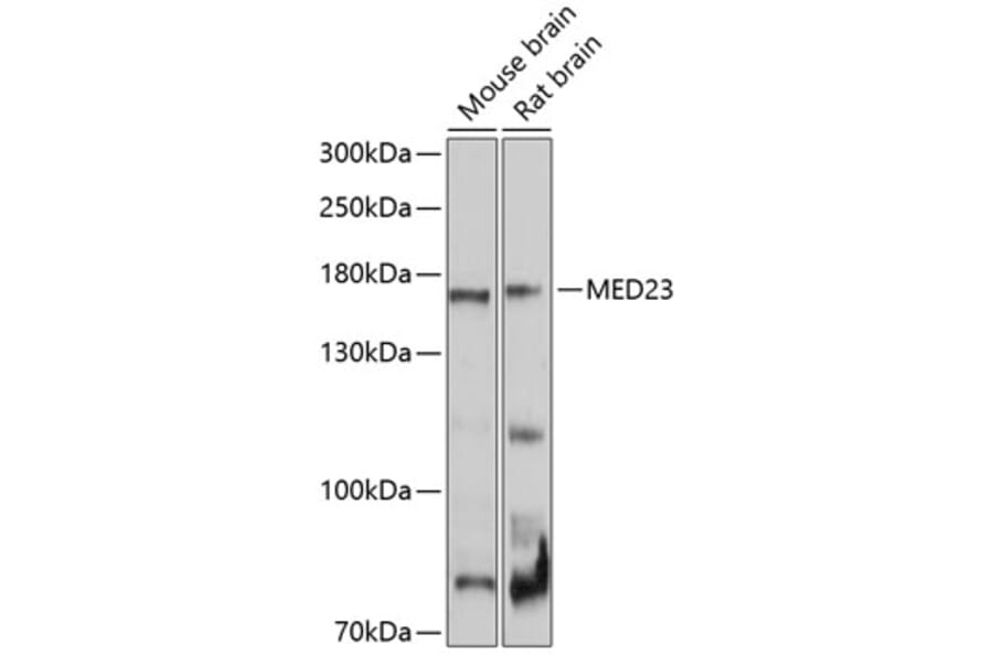 Western Blot - Anti-MED23 Antibody (A10163) - Antibodies.com