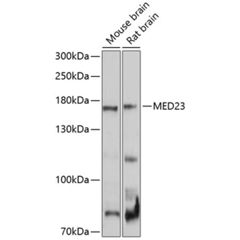 Western Blot - Anti-MED23 Antibody (A10163) - Antibodies.com
