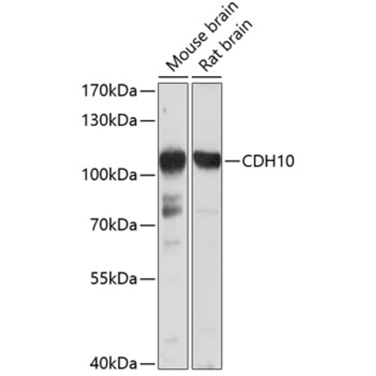 Western Blot - Anti-CDH10 Antibody (A10204) - Antibodies.com