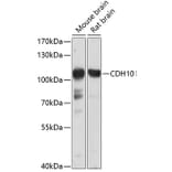 Western Blot - Anti-CDH10 Antibody (A10204) - Antibodies.com