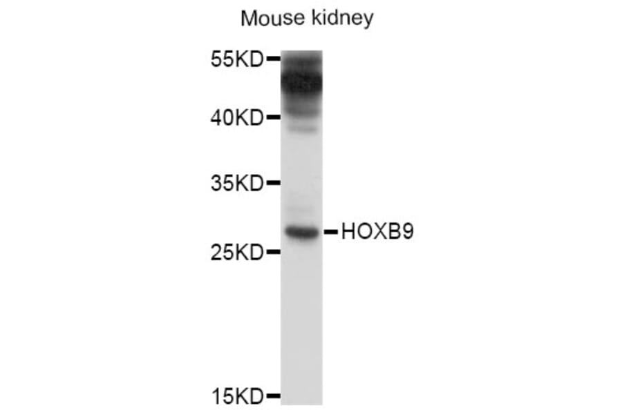 Western Blot - Anti-HOXB9 Antibody (A10222) - Antibodies.com
