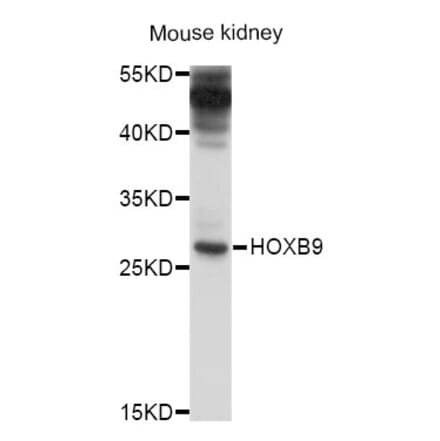 Western Blot - Anti-HOXB9 Antibody (A10222) - Antibodies.com