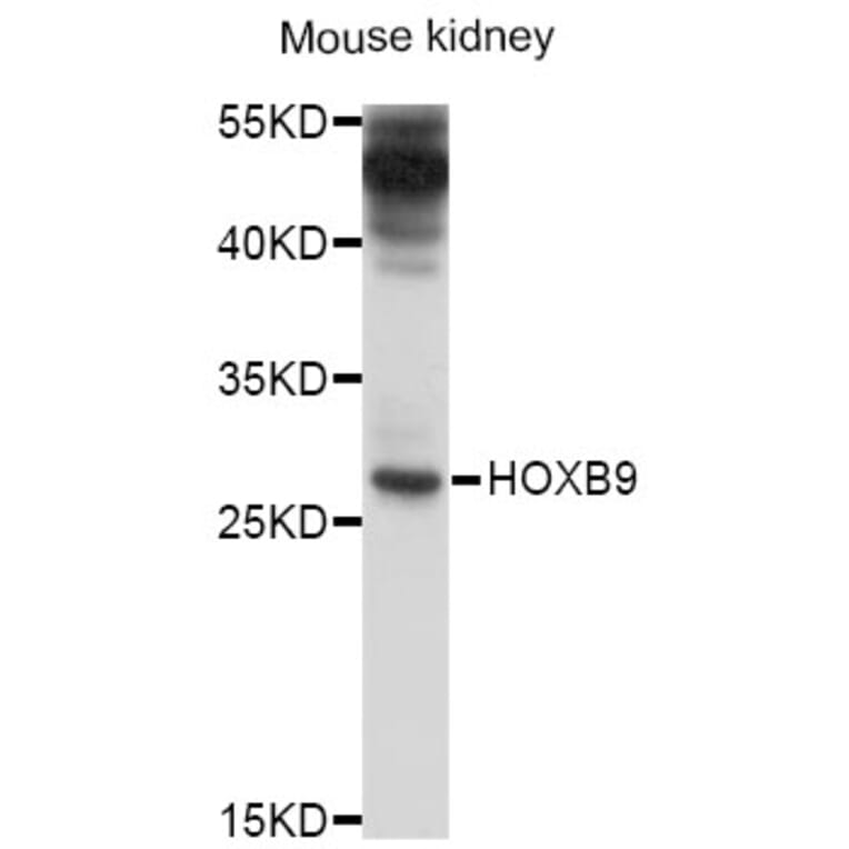 Western Blot - Anti-HOXB9 Antibody (A10222) - Antibodies.com