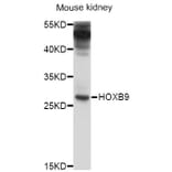 Western Blot - Anti-HOXB9 Antibody (A10222) - Antibodies.com