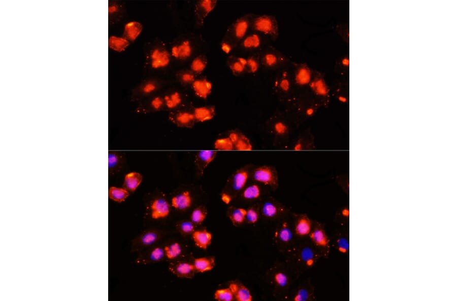 Immunofluorescence - Anti-HOXB9 Antibody (A10222) - Antibodies.com