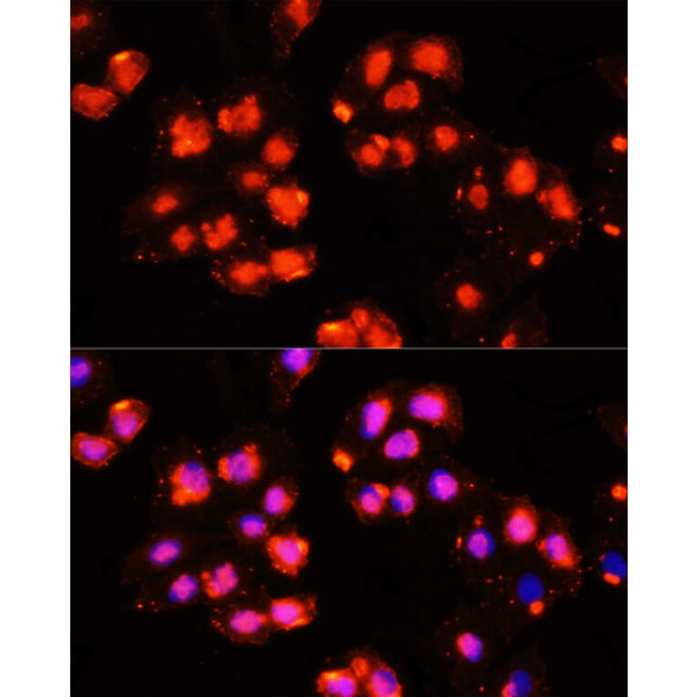 Immunofluorescence - Anti-HOXB9 Antibody (A10222) - Antibodies.com