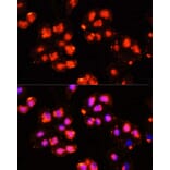 Immunofluorescence - Anti-HOXB9 Antibody (A10222) - Antibodies.com