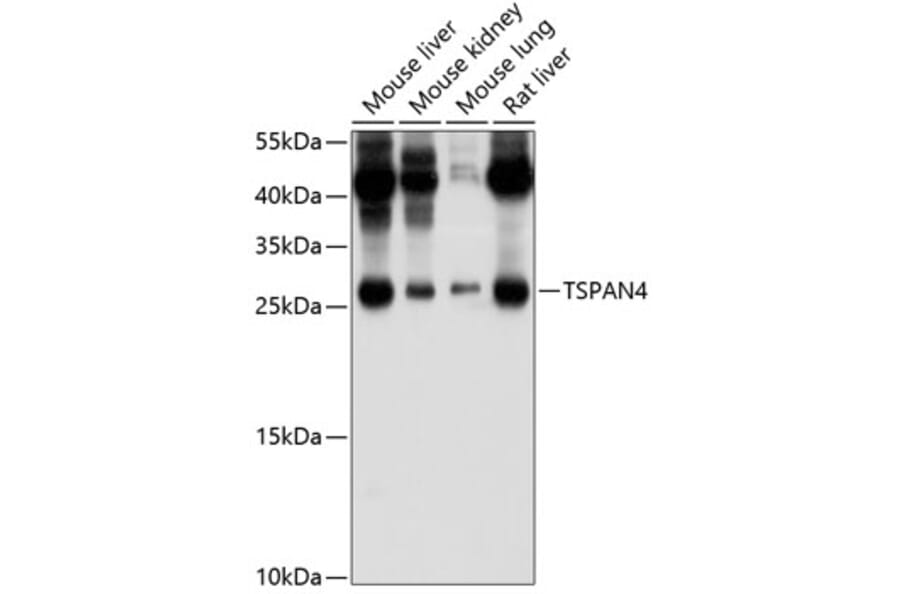 Western Blot - Anti-NAG-2 Antibody (A17154) - Antibodies.com