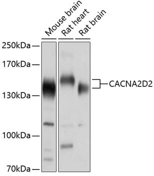 Western blot analysis of extracts of various cell lines, using Anti-CACNA2D2 Antibody (A10267) at 1:1,000 dilution.
Secondary antibody: Goat Anti-Rabbit IgG (H+L) (HRP) (AS014) at 1:10,000 dilution.
Lysates / proteins: 25µg per lane.
Blocking buffer: 3% non-fat dry milk in TBST.
Detection: ECL Enhanced Kit (RM00021).
Exposure time: 1s.