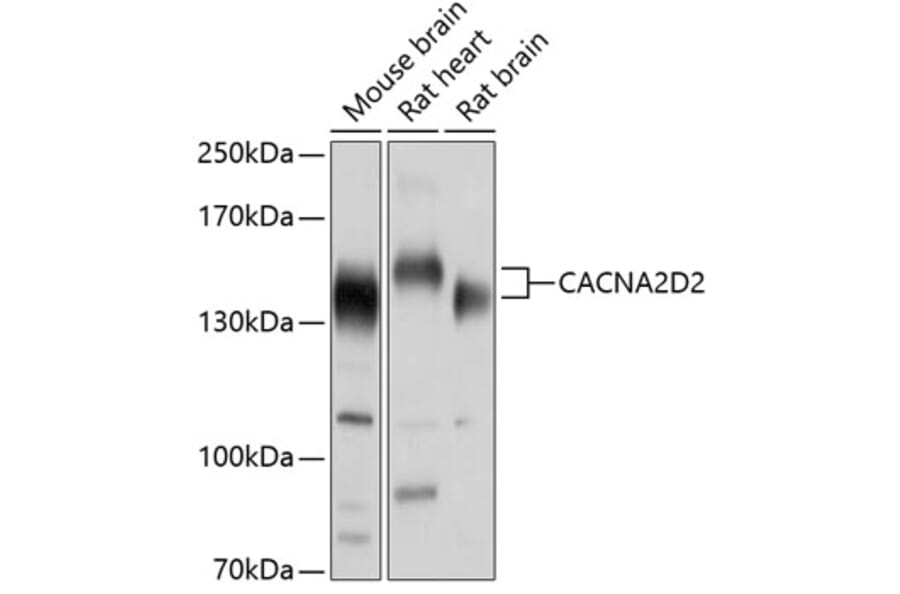 Western Blot - Anti-CACNA2D2 Antibody (A17156) - Antibodies.com