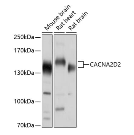 Western Blot - Anti-CACNA2D2 Antibody (A17156) - Antibodies.com