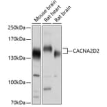 Western Blot - Anti-CACNA2D2 Antibody (A17156) - Antibodies.com