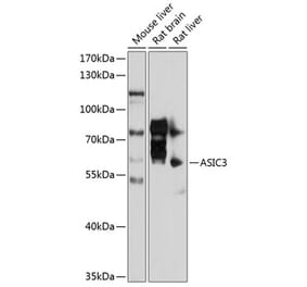 Western Blot - Anti-ASIC3 Antibody (A17157) - Antibodies.com