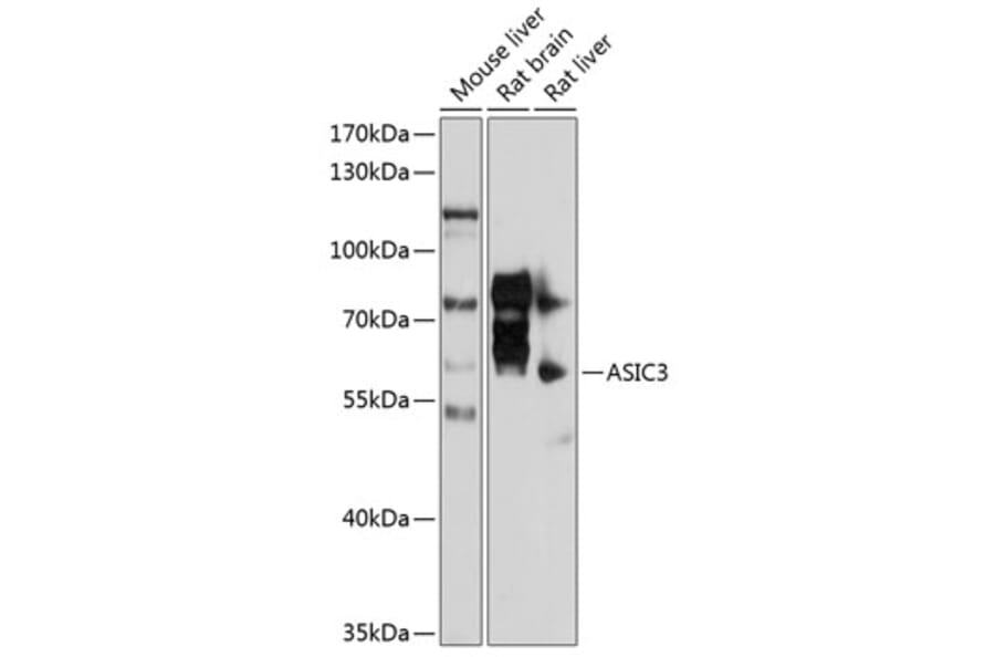 Western Blot - Anti-ASIC3 Antibody (A17157) - Antibodies.com