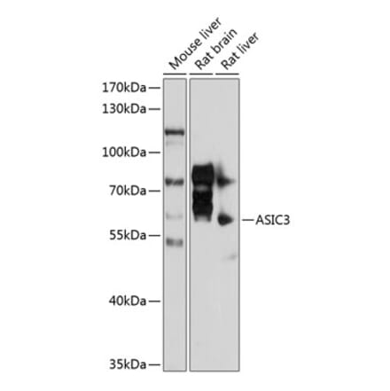 Western Blot - Anti-ASIC3 Antibody (A17157) - Antibodies.com