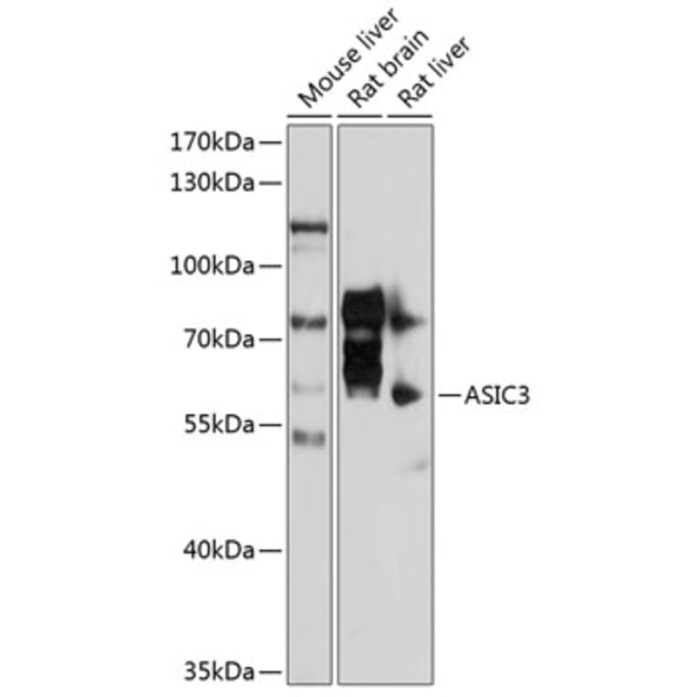 Western Blot - Anti-ASIC3 Antibody (A17157) - Antibodies.com