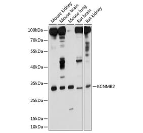 Western Blot - Anti-KCNMB2 Antibody (A17158) - Antibodies.com