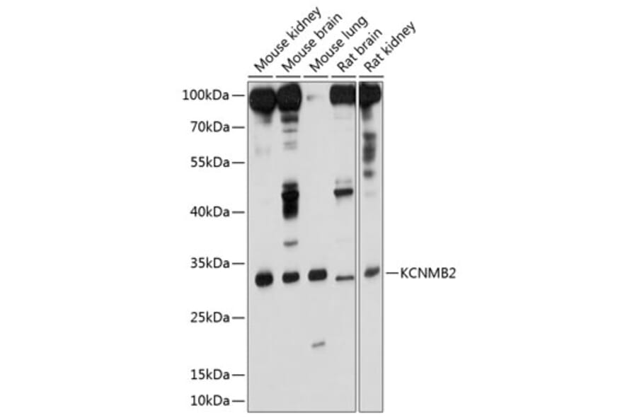 Western Blot - Anti-KCNMB2 Antibody (A17158) - Antibodies.com