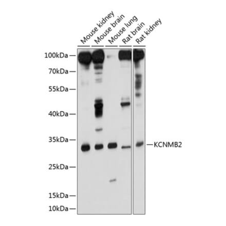 Western Blot - Anti-KCNMB2 Antibody (A17158) - Antibodies.com