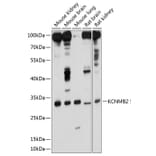 Western Blot - Anti-KCNMB2 Antibody (A17158) - Antibodies.com