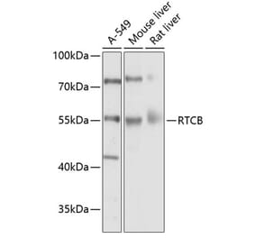 Western Blot - Anti-C22orf28 Antibody (A17159) - Antibodies.com