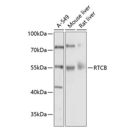Western Blot - Anti-C22orf28 Antibody (A17159) - Antibodies.com