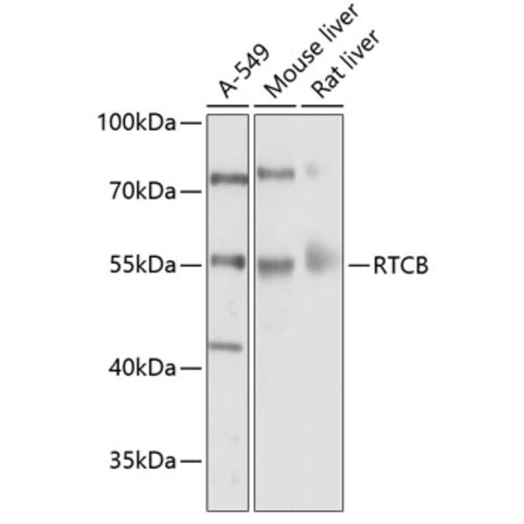 Western Blot - Anti-C22orf28 Antibody (A17159) - Antibodies.com