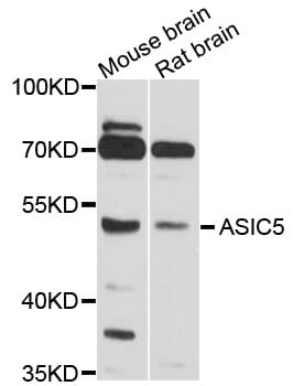 Western blot analysis of extracts of various cell lines, using Anti-ASIC5 Antibody (A10307) at 1:1,000 dilution.
Secondary antibody: Goat Anti-Rabbit IgG (H+L) (HRP) (AS014) at 1:10,000 dilution.
Lysates / proteins: 25µg per lane.
Blocking buffer: 3% non-fat dry milk in TBST.
Detection: ECL Basic Kit (RM00020).
Exposure time: 30s.