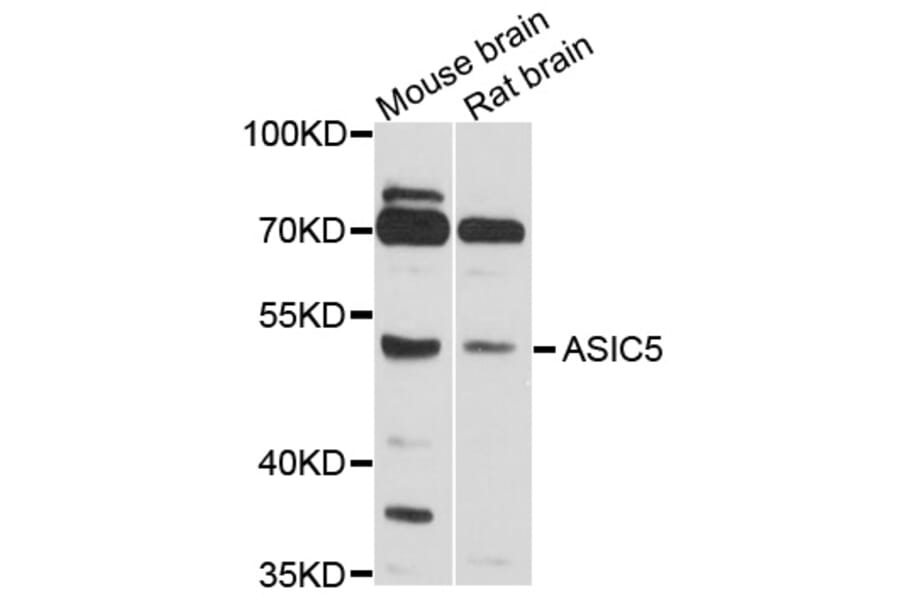 Western Blot - Anti-ASIC5 Antibody (A10307) - Antibodies.com