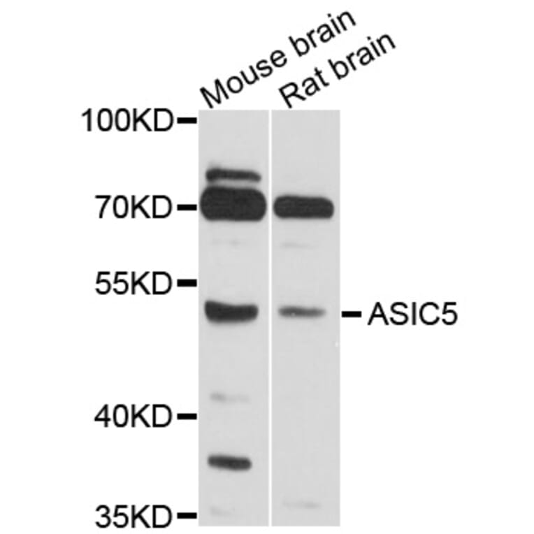 Western Blot - Anti-ASIC5 Antibody (A10307) - Antibodies.com