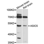 Western Blot - Anti-ASIC5 Antibody (A10307) - Antibodies.com