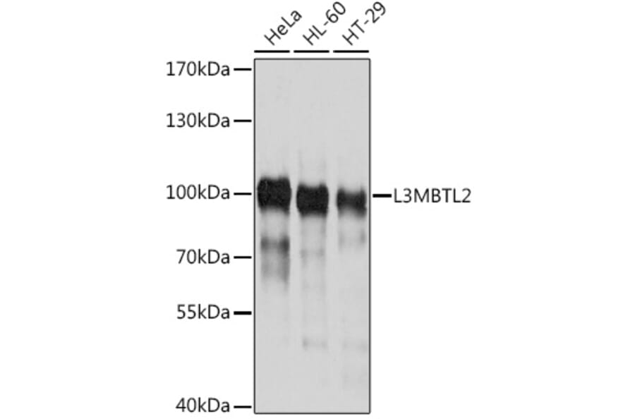 Western Blot - Anti-L3MBTL2 Antibody (A17161) - Antibodies.com