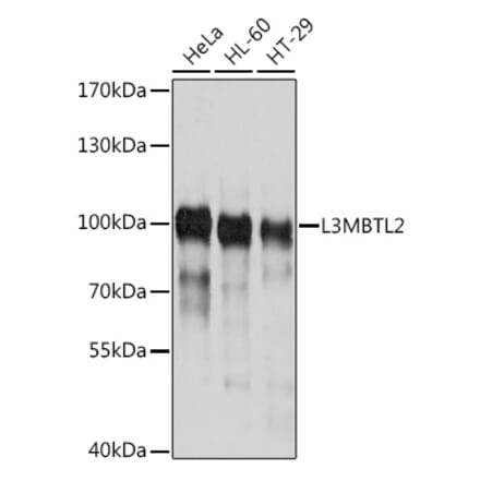 Western Blot - Anti-L3MBTL2 Antibody (A17161) - Antibodies.com