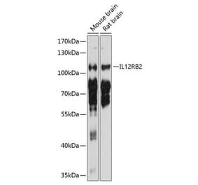 Western Blot - Anti-IL-12RB2 Antibody (A17162) - Antibodies.com