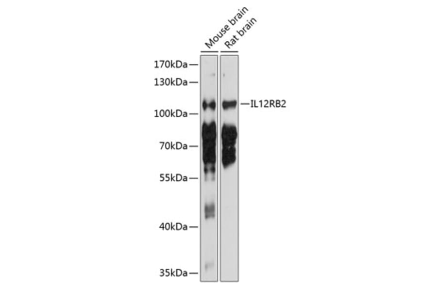 Western Blot - Anti-IL-12RB2 Antibody (A17162) - Antibodies.com